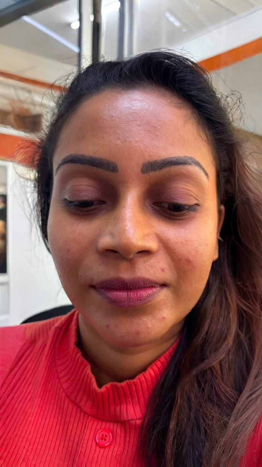Microdermabrasion Facial, after