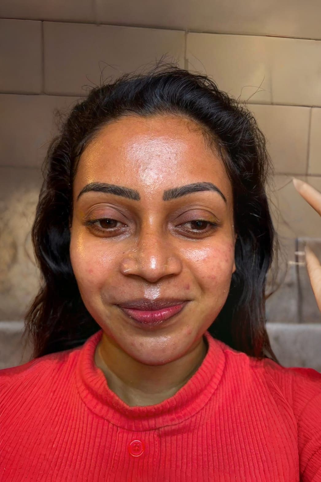 Microdermabrasion Facial, before